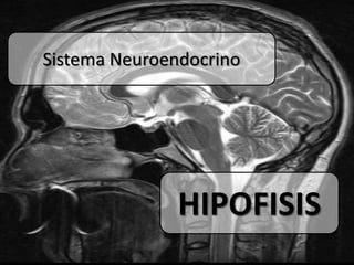 Sistema Neuroendocrino




               HIPOFISIS
 