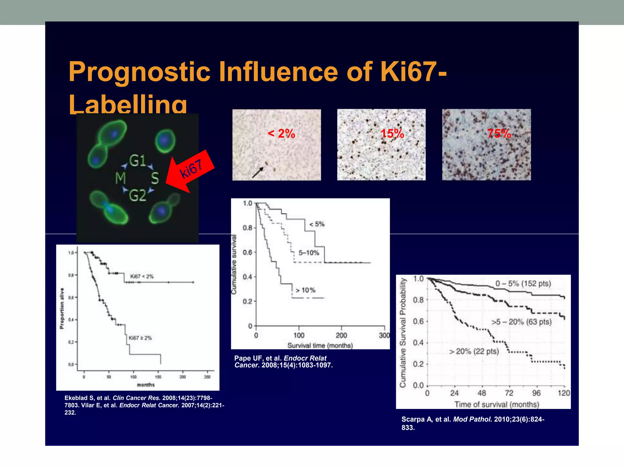 Scarpa A, et al. Mod Pathol. 2010;23(6):824-
833.
Prognostic Influence of Ki67-
Labelling
< 2% 15% 75%
Pape UF, et al. Endocr Relat
Cancer. 2008;15(4):1083-1097.
Ekeblad S, et al. Clin Cancer Res. 2008;14(23):7798-
7803. Vilar E, et al. Endocr Relat Cancer. 2007;14(2):221-
232.
 