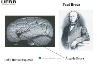 Paul Broca




Lobo frontal esquerdo    Área de Broca
 