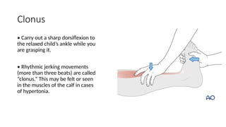 Left Clonus neuro exam BM.pptx, neurological examination in children | PPTX