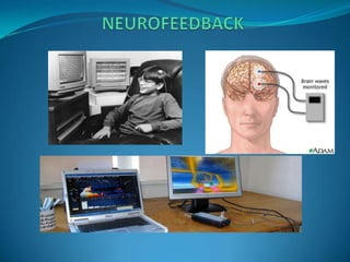                   NEUROFEEDBACK