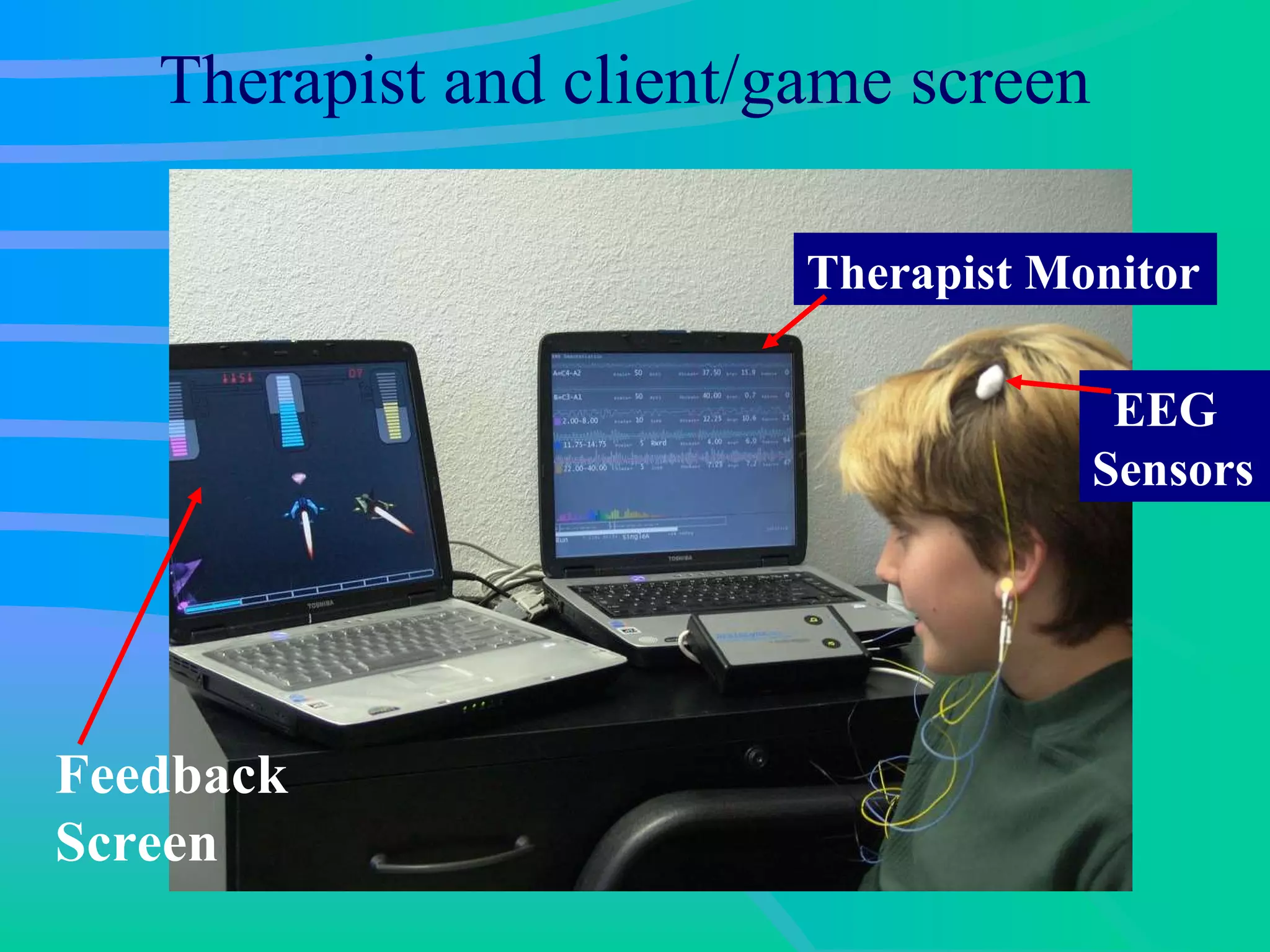 Therapist and client/game screen Feedback Screen Therapist Monitor EEG Sensors 