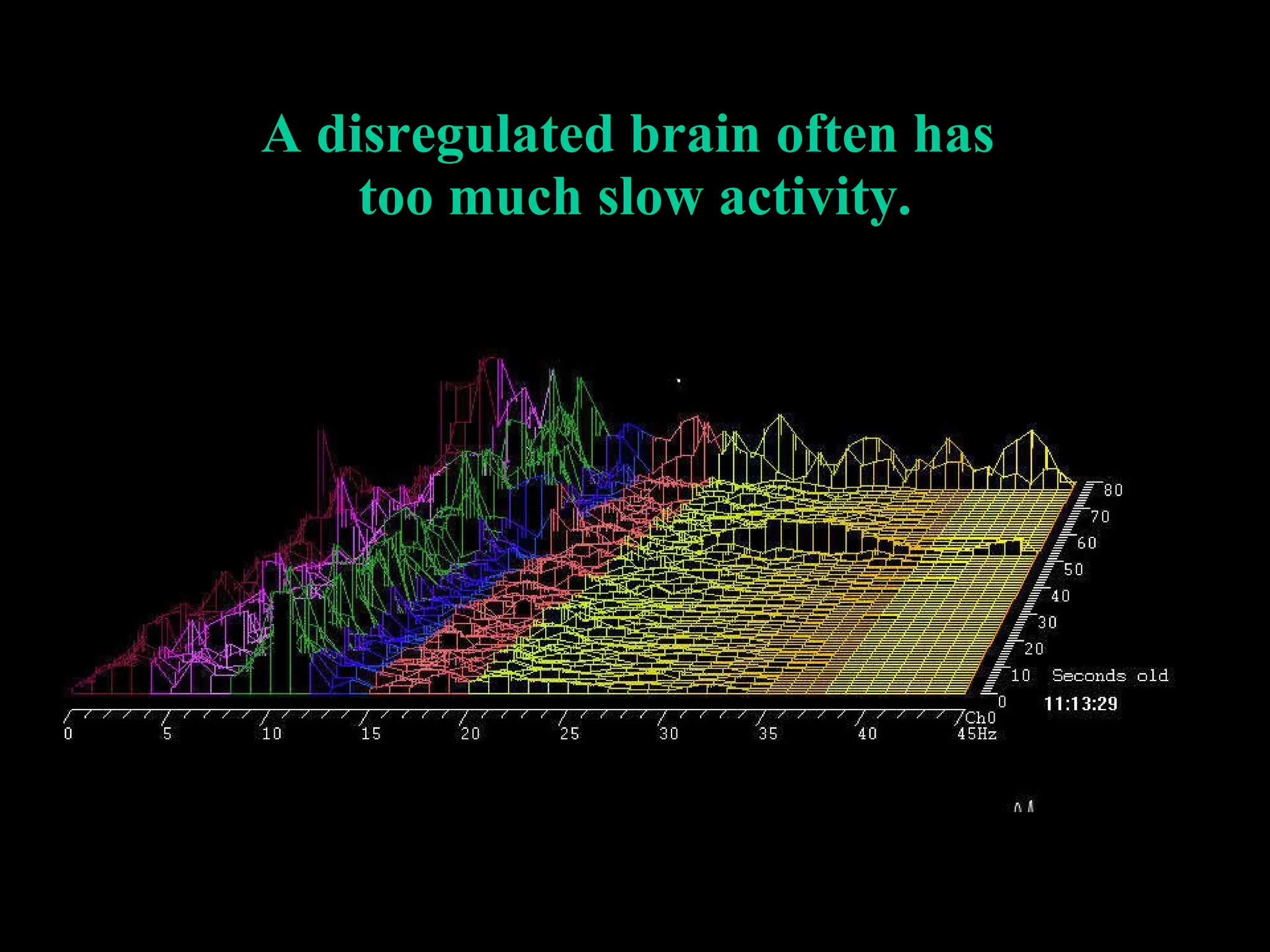 A disregulated brain often has  too much slow activity. 