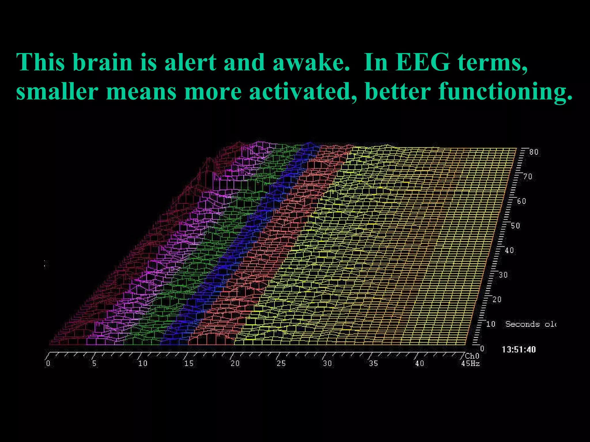 This brain is alert and awake.  In EEG terms, smaller means more activated, better functioning. 