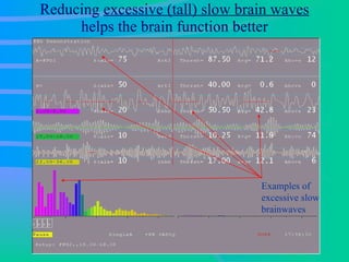 Reducing  excessive (tall) slow brain waves  helps the brain function better Examples of excessive slow brainwaves 