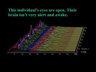 This individual’s eyes are open. Their brain isn’t very alert and awake.   