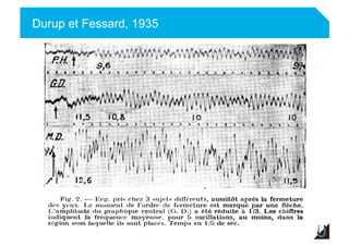 Durup et Fessard, 1935
 
