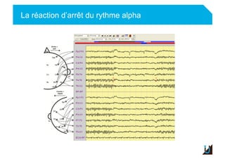 La réaction d’arrêt du rythme alpha
Adulte
 