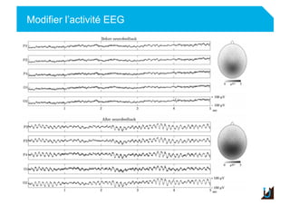 Modifier l’activité EEG
Adulte
 