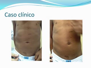 Caso clínico
 