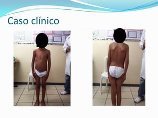 Caso clínico
 