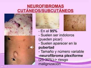 NEUROFIBROMAS
CUTÁNEOS/SUBCUTÁNEOS



       - En el 95%
       - Suelen ser indoloros
       (pueden picar)
       - Suelen aparecer en la
       pubertad
       - Tamaño y número variable
       -neurofibroma plexiforme
       (25-30%)-> riesgo
       malignización
 