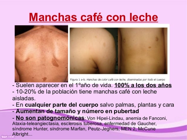 Los regímenes muy rigurosos y eficaces para el adelgazamiento