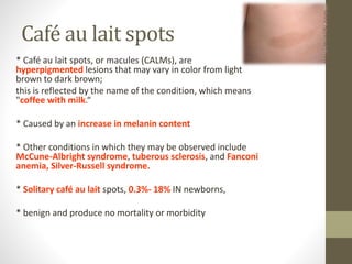 Neurofibromatosis | PPTX