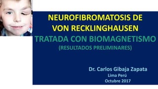 NEUROFIBROMATOSIS DE
VON RECKLINGHAUSEN
TRATADA CON BIOMAGNETISMO
(RESULTADOS PRELIMINARES)
Dr. Carlos Gibaja Zapata
Lima Perú
Octubre 2017
 