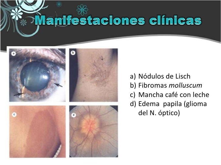 Mancha De Cafe Mancha De Cafe