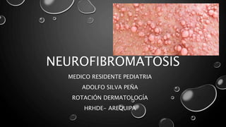 NEUROFIBROMATOSIS
MEDICO RESIDENTE PEDIATRIA
ADOLFO SILVA PEÑA
ROTACIÓN DERMATOLOGÍA
HRHDE- AREQUIPA
 
