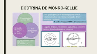 DOCTRINA DE MONRO-KELLIE
 