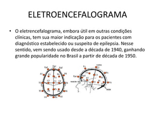 ELETROENCEFALOGRAMA
• O eletrencefalograma, embora útil em outras condições
clínicas, tem sua maior indicação para os pacientes com
diagnóstico estabelecido ou suspeito de epilepsia. Nesse
sentido, vem sendo usado desde a década de 1940, ganhando
grande popularidade no Brasil a partir de década de 1950.
 