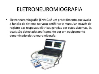 ELETRONEUROMIOGRAFIA
• Eletroneuromiografia (ENMG) é um procedimento que avalia
a função do sistema nervoso periférico e muscular através do
registro das respostas elétricas geradas por estes sistemas, às
quais são detectadas graficamente por um equipamento
denominado eletroneuromiógrafo.
 