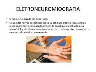 ELETRONEUROMIOGRAFIA
• O exame é realizado em duas fases:
• Estudo dos nervos periféricos: aplica-se estímulo elétrico registrando a
resposta do nervo estudado (potencial de ação) que é analisado pelo
neurofisiologista clínico, comparando-se com o lado oposto, bem como os
valores padronizados de referência.
 