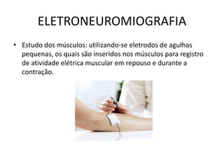 ELETRONEUROMIOGRAFIA
• Estudo dos músculos: utilizando-se eletrodos de agulhas
pequenas, os quais são inseridos nos músculos para registro
de atividade elétrica muscular em repouso e durante a
contração.
 