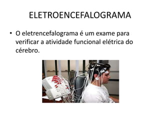 ELETROENCEFALOGRAMA
• O eletrencefalograma é um exame para
verificar a atividade funcional elétrica do
cérebro.
 