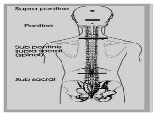 Neurogenicbladder 140711115804-phpapp01 | PPTX