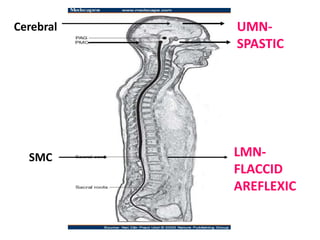 Neurogenicbladder 140711115804-phpapp01 | PPTX