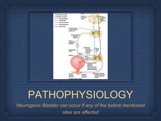 PATHOPHYSIOLOGY
Neurogenic Bladder can occur if any of the before mentioned
sites are affected