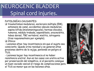 NEUROGENIC BLADDER
Spinal cord injuries.
PATOLOGÍAS CAUSANTES:
 traumatismos medulares, esclerosis múltiple (EM),
estenosis de canal, accidentes vásculo-medulares,
espina bífida (mielomeningocele), hernias discales,
tumores, médula trabada, espondilosis, aracnoiditis,
tabes dorsal, TBC vertebral, mielitis, iatrogenia
(tras raquianestesia por ejemplo).
 Clínica:
- Lesiones altas: hay incontinencia sin que el sujeto sea
consciente. Queda orina residual y se generan altas
presiones dentro de la vejiga, poniendo en peligro al
TUS.
- Lesiones bajas: hay incontinencia al no haber
resistencia uretral. Aun en los casos con uretra activa
por preservación del simpático, si el paciente consigue
un buen vaciado vesical el riesgo de complicaciones para
el TUS es menor que en las lesiones altas.
 
