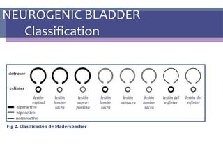 NEUROGENIC BLADDER
Classification
 