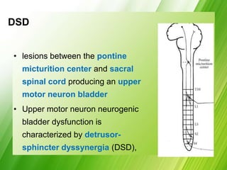 DSD
• lesions between the pontine
micturition center and sacral
spinal cord producing an upper
motor neuron bladder
• Upper motor neuron neurogenic
bladder dysfunction is
characterized by detrusor-
sphincter dyssynergia (DSD),
 