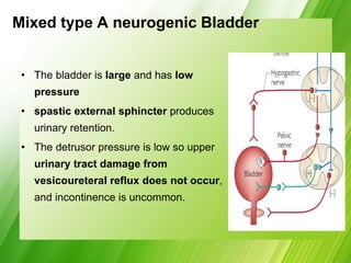 Mixed type A neurogenic Bladder
• The bladder is large and has low
pressure
• spastic external sphincter produces
urinary retention.
• The detrusor pressure is low so upper
urinary tract damage from
vesicoureteral reflux does not occur,
and incontinence is uncommon.
 