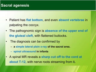 • Patient has flat bottom, and even absent vertebrae in
palpating the coccyx.
• The pathognomic sign is absence of the upper end of
the gluteal cleft, with flattened buttocks.
• The diagnosis can be confirmed by
– a simple lateral plain x-ray of the sacral area.
– spinal ultrasound in infants
• A spinal MR reveals a sharp cut off to the cord at
about T-12, with nerve roots streaming from it.
Sacral agenesis
 