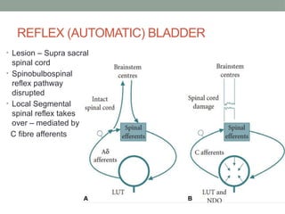 Reflex Bladder Neurogenic Bladder - Neurology of Urinary bladder.pptx