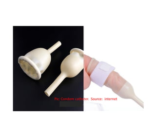 Pic: Condom catheter. Source: internet
 