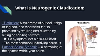Neurogenic Claudication.. Pptx file.... | PPTX