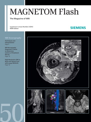 MAGNETOM Flash 
The Magazine of MRI 
Supplement to Issue Number 2/2012 
RSNA Edition 
MR Neurography 
Techniques and 
Interpretation 
Page 4 
MR Neurography 
Diagnostic Criteria 
to Determine 
Lesions of Peripheral 
Nerves 
Page 10 
High-Resolution DWI in 
Brain and Spinal Cord 
with syngo RESOLVE 
Page 16 
 