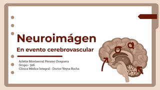 Neuroimaging Techniques and Interpretation in Acute Ischemic Stroke ...