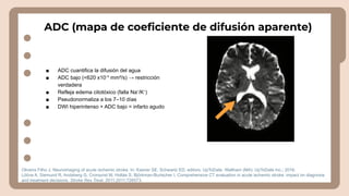 Neuroimaging Techniques and Interpretation in Acute Ischemic Stroke ...
