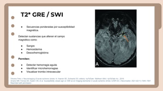 Neuroimaging Techniques and Interpretation in Acute Ischemic Stroke ...