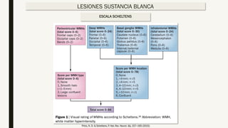 Neuroimagen estructural demencias | PDF