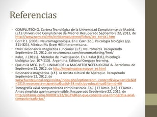 Referencias
• COMPLUTECNO. Cartera Tecnológica de la Universidad Complutense de Madrid.
(s.f.). Universidad Complutense de Madrid. Recuperado Septiembre 22, 2012, de
http://www.ucm.es/info/otri/complutecno/fichas/tec_tortiz1.htm
• Corr P. J. (2008). Neuroimagenología. En J. Corr (Ed.), Psicología biológica (pp.
311-321). México: Mc Graw Hill Interamericana.
• fMRI. Resonancia Magnética Funcional. (s.f.). Neuromarca. Recuperado
Septiembre 22, 2012, de neuromarca.com/neuromarketing/fmri/
• Kalat, J. (2011). Métodos de Investigación. En J. Kalat (Ed.), Psicología
biológica (pp. 107-113). Argentina: Editorial Cengage learning.
• Qué es la MEG. (s.f.). UNIDAD DE LA MAGNETOENCEFALOGRAFIA -Barcelona. de
Septiembre 22, 2012, de http://megimaging.es/que_es.html
• Resonancia magnética. (s.f.). La revista cultural de Aljaraque. Recuperado
Septiembre 22, 2012, de
www.fuentejuncal.org/revista/index.php?option=com_content&view=article&id
=1313:resonancia-magnetica&catid=38:noticias-educativas&Itemid=66
• Tomografía axial computerizada computarizada TAC | El Tamiz. (s.f.). El Tamiz -
Antes simplista que incomprensible. Recuperado Septiembre 22, 2012, de
http://eltamiz.com/2008/01/22/%C2%BFen-que-consiste-una-tomografia-axial-
computarizada-tac/
 