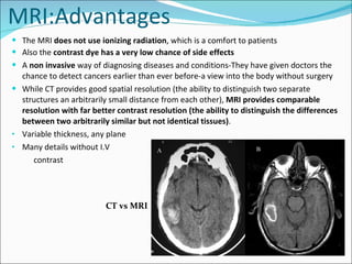 MRI:Advantages The MRI  does not use ionizing radiation , which is a comfort to patients Also the  contrast dye has a very low chance of side effects A  non invasive  way of diagnosing diseases and conditions-They have given doctors the chance to detect cancers earlier than ever before-a view into the body without surgery While CT provides good spatial resolution (the ability to distinguish two separate structures an arbitrarily small distance from each other),  MRI provides comparable resolution with far better contrast resolution (the ability to distinguish the differences between two arbitrarily similar but not identical tissues) .  Variable thickness, any plane Many details without I.V  contrast CT vs MRI 
