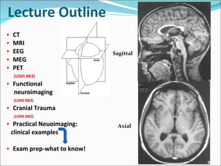 Lecture Outline  CT MRI EEG MEG PET (LO#5 BB3) Functional  neuroimaging  (LO#6 BB3) Cranial Trauma  (LO#6 BB2) Practical Neuoimaging:  clinical examples Exam prep-what to know! Sagittal Axial 