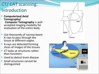 CT/ CAT scanning: Introduction Computerised Axial Tomography/  Computer Tomography  is well accepted imaging modality for evaluation of the entire body. Use thousands of narrow-beam X-rays to pass through the tissue at different angles X-rays are detected forming slices of images of the tissues CT looks at structures rather than functions Used to detect brain disease Small structures cannot be distinguished 