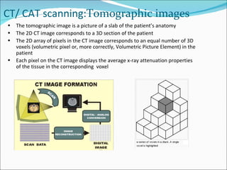 CT/ CAT scanning: Tomographic images The tomographic image is a picture of a slab of the patient’s anatomy The 2D CT image corresponds to a 3D section of the patient The 2D array of pixels in the CT image corresponds to an equal number of 3D voxels (volumetric pixel or, more correctly, Volumetric Picture Element) in the patient Each pixel on the CT image displays the average x-ray attenuation properties of the tissue in the corresponding  voxel 