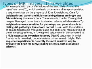 Neuroimaging Lecture Slide 16