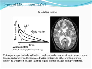 Neuroimaging Lecture Slide 18